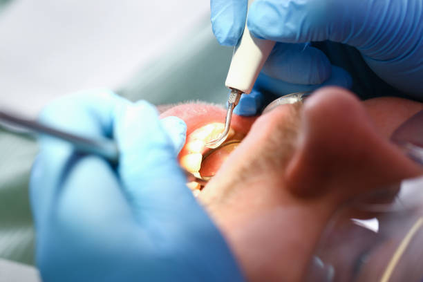 Best Broken Tooth Emergency  in East Pepperell, MA