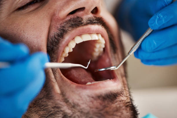 Best Broken Tooth Emergency  in East Pepperell, MA